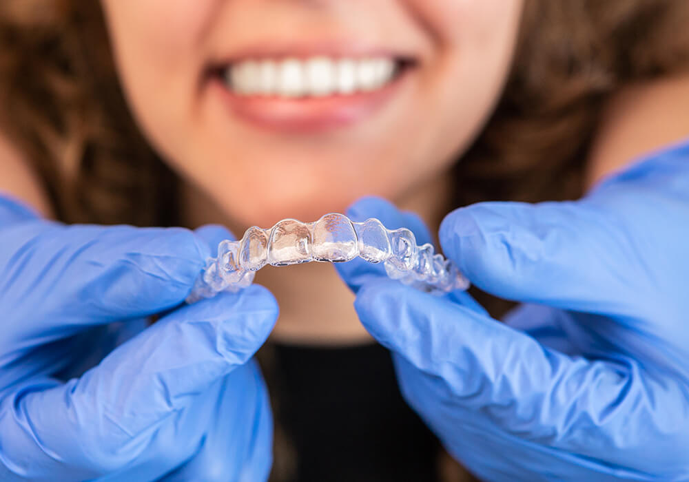 Clear Aligner FAQs: Costs, Process, Candidacy & More