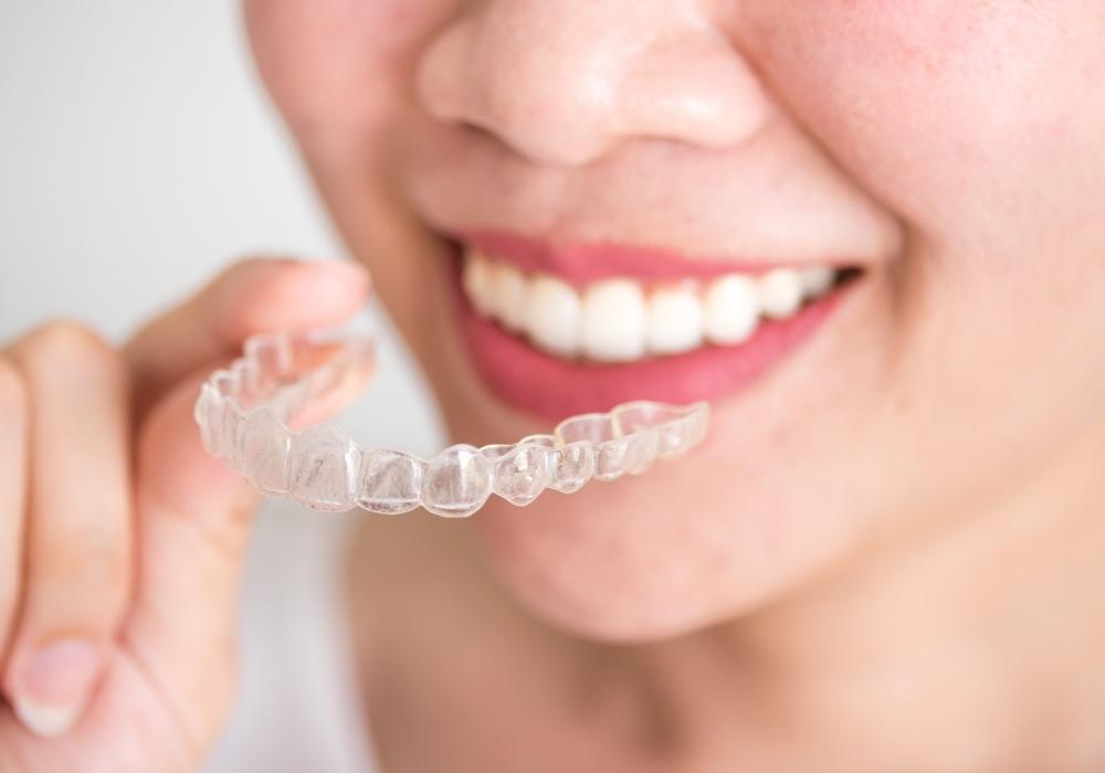 Invisalign: Cost, Quick Fixes and Elastics
