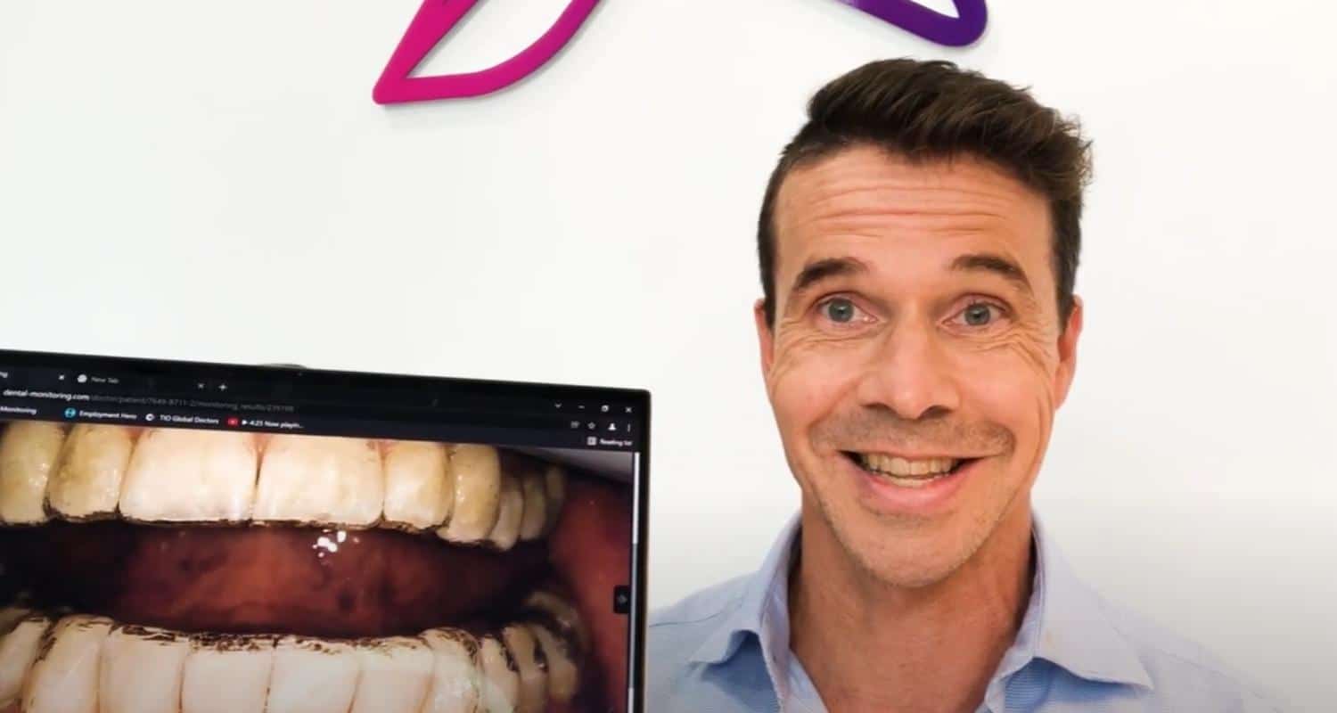 Dental Monitoring